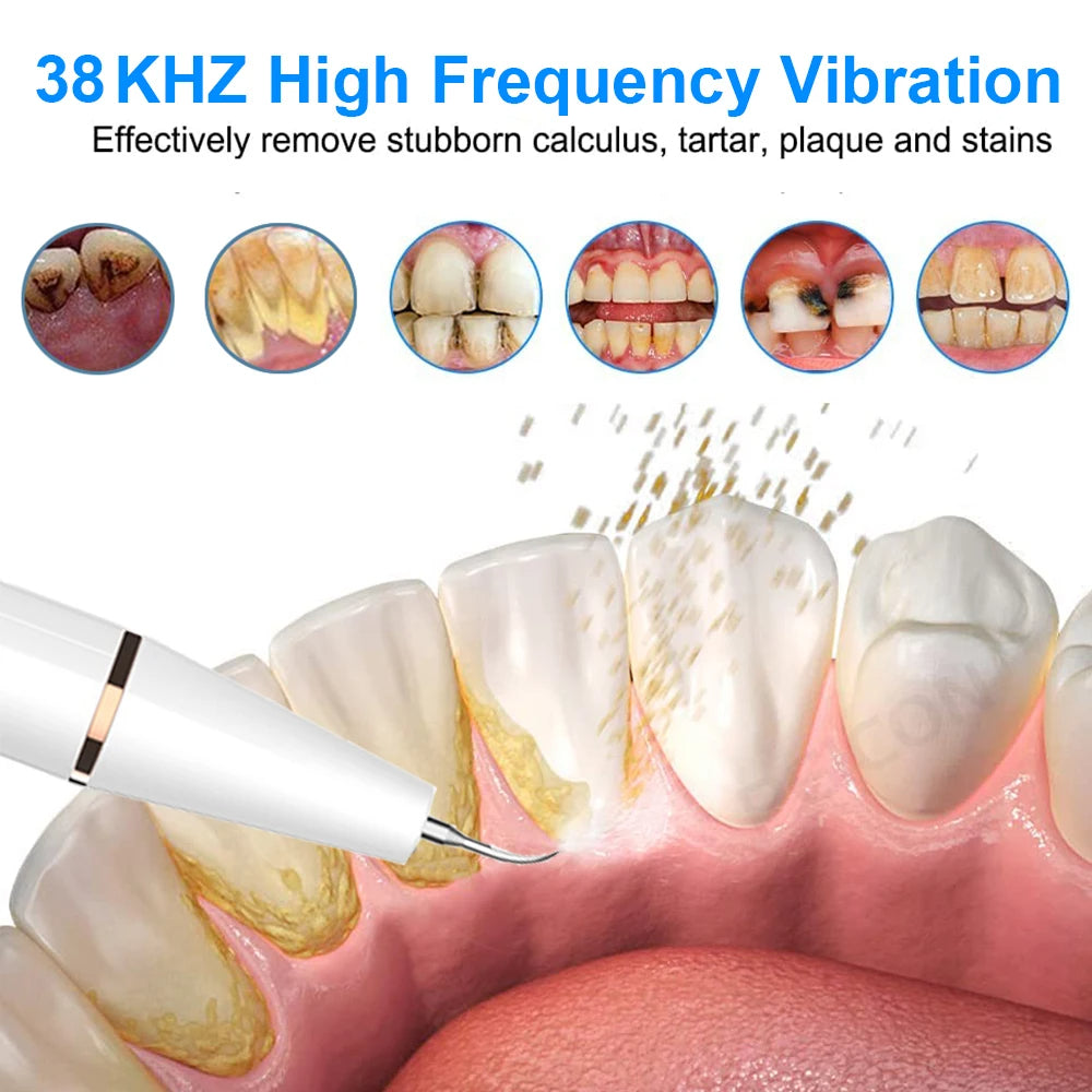 Ultrasonic dental teeth plaque remover and cleaner for a professional clean, designed to remove plaque, tartar, and stains while promoting healthier teeth and gums.