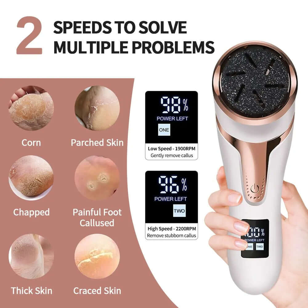 Electric foot callus remover for smooth, soft feet, designed to effortlessly remove hard skin and calluses with adjustable settings for a personalised, gentle treatment.