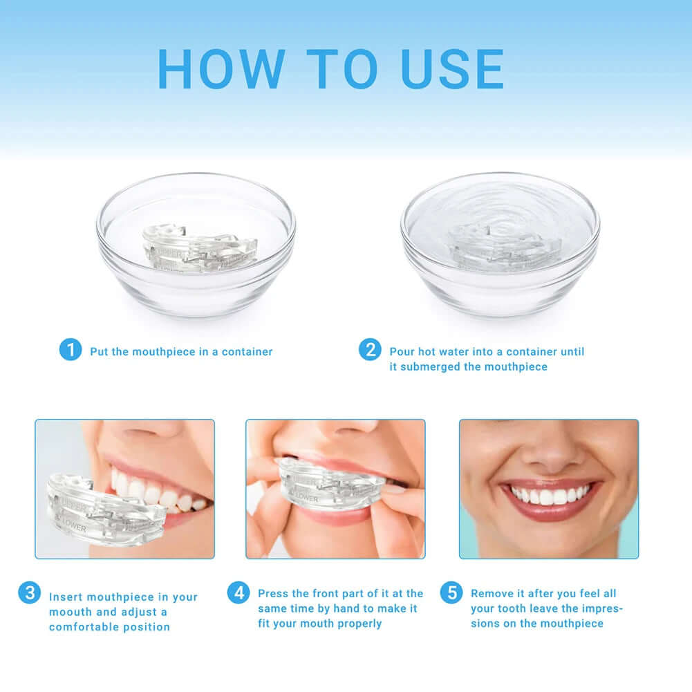 Anti-snoring mouth guard for better sleep, designed to reduce snoring by gently repositioning the jaw to improve airflow and prevent discomfort during the night.