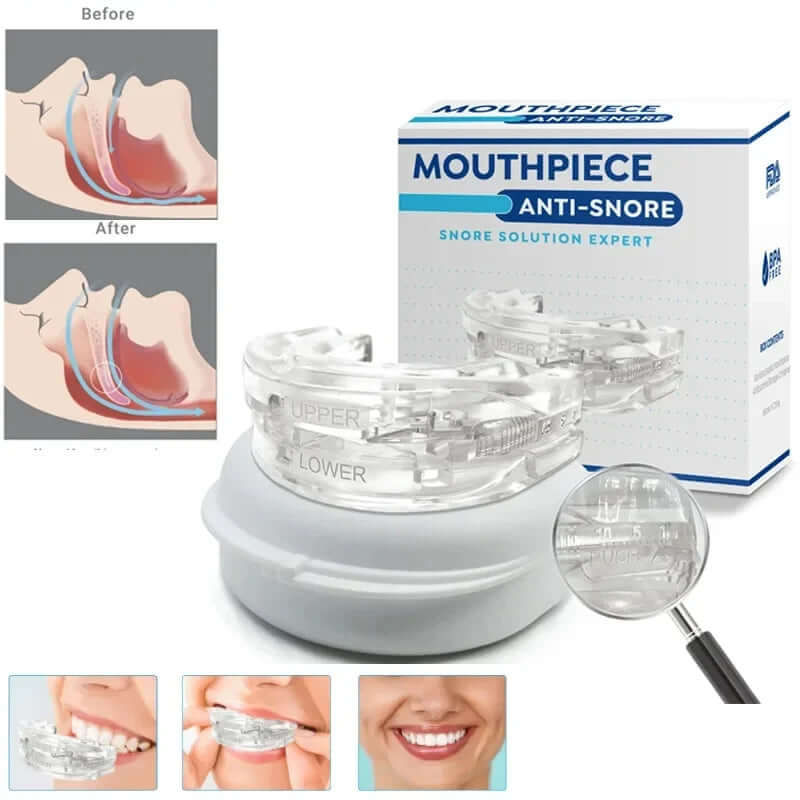 Anti-snoring mouth guard for better sleep, designed to reduce snoring by gently repositioning the jaw to improve airflow and prevent discomfort during the night.